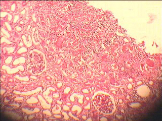kidney1.jpg